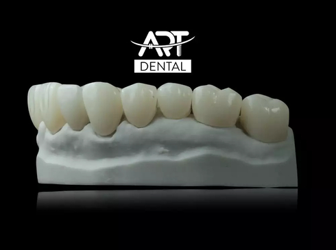 Slider image (7) Art Dental Care